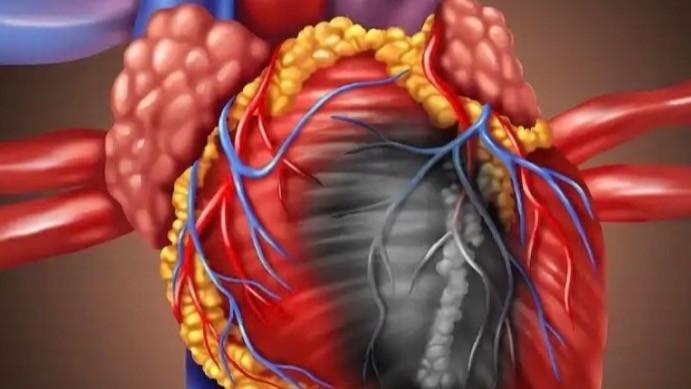 数万案例复盘:从心源性猝死机制透视预防逻辑 新闻 数万案例复盘:从心源性猝死机制透视预防逻辑 新闻